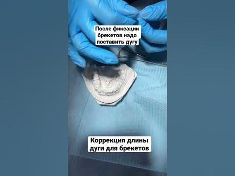 Дуга для брекетов - YouTube