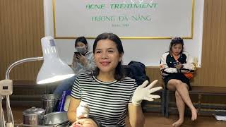 Acne Treatment Huong Da Nang# membership 020 | happy start of the week