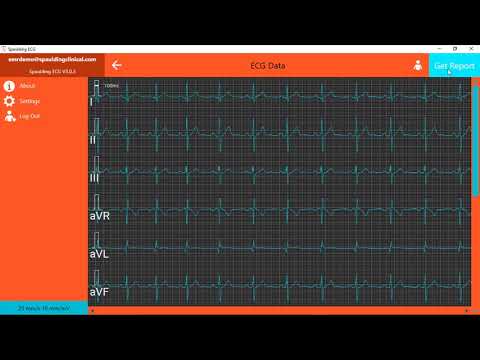 Spaulding Core ECG Rave Integration 2018