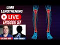 Height Journey Interview - Tibia Lengthening in Consolidation Phase - October 13, 2022