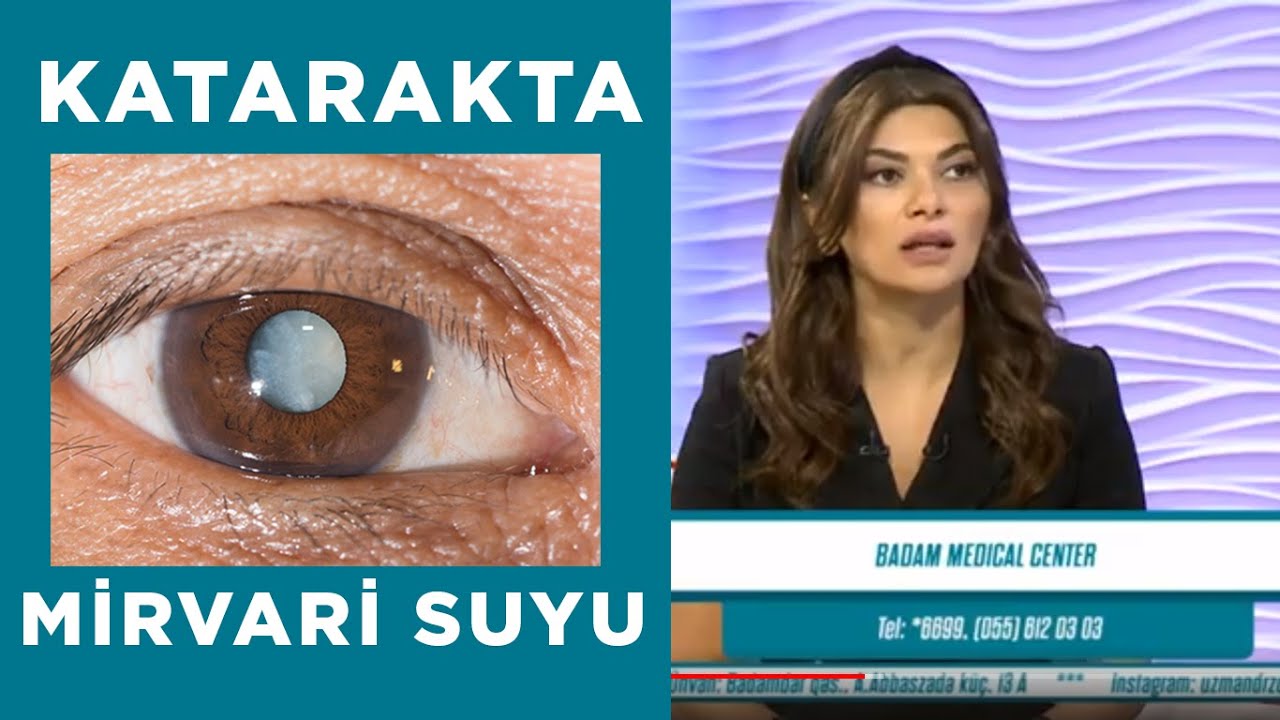 Yaşlandıqca yaranan göz xəstəliyi KATARAKTANIN (MİRVARİ SUYU) müalicəsi varmı?