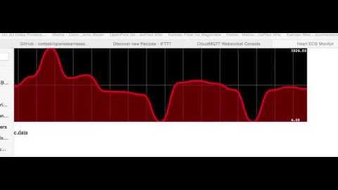 Heart ECG Demo - I am still living!  LOL!