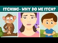 Itching- Why do we Itch? - Remedies and Treatment - Video for Kids