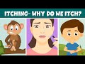 Understanding Itching