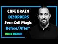 Curing Autism, Epilepsy & Schizophrenia with Stem Cells? Groundbreaking 2026 Breakthroughs!
