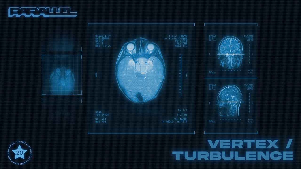 Watch Parallel - Turbulence on YouTube Watch Parallel - Turbulence on YouTube