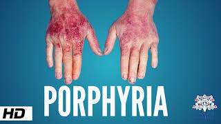 Porphyria, Causes, Signs and Symptoms, Diagnosis and Treatment.