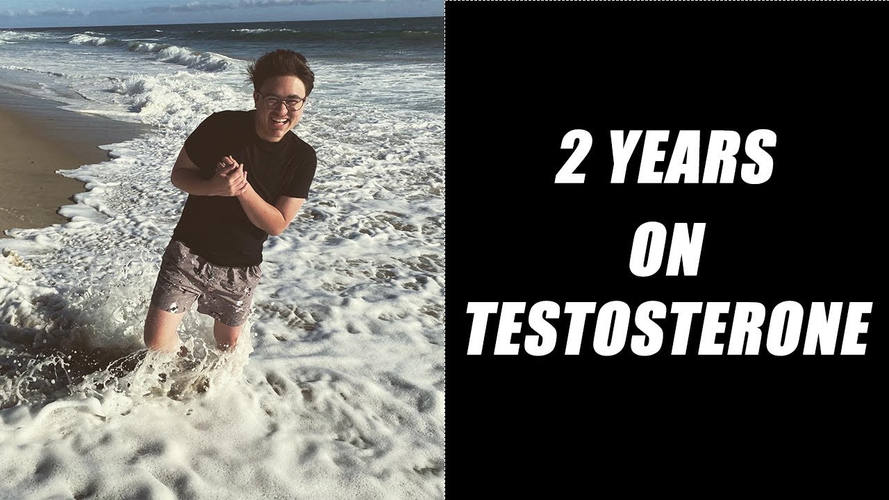 2 Years on Testosterone || FTM/Trans Masculine ||