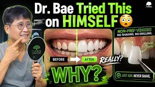 Dr Bae Tried Non-Prep Veneers on Himself Here s What He Learned