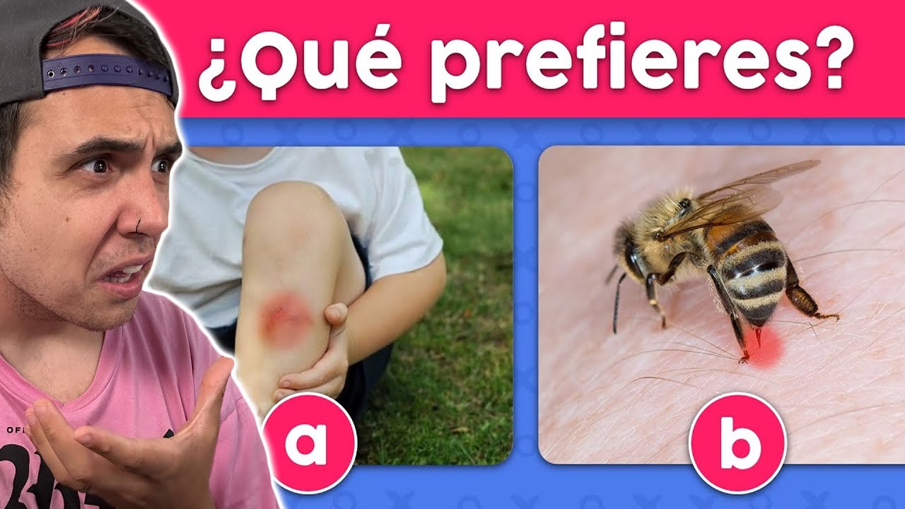 ¿QUÉ PREFIERES? 🅰️🆚🅱️ ¡TEN CUIDADO AL ELEGIR! CHOCOBLOX REACIONA