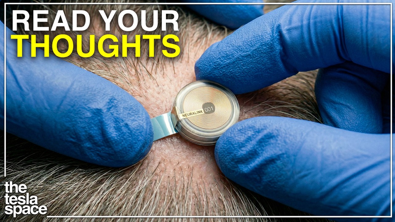 Neuralink Just Did The Impossible