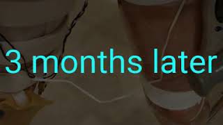 My Slow Transition to HKAFO braces