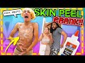 MY SKIN IS PEELING PRANK on my PARENTS!! *THEY GO CRAAZY* 🤣