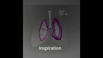 Tension Pneumothorax explained in 1 minute