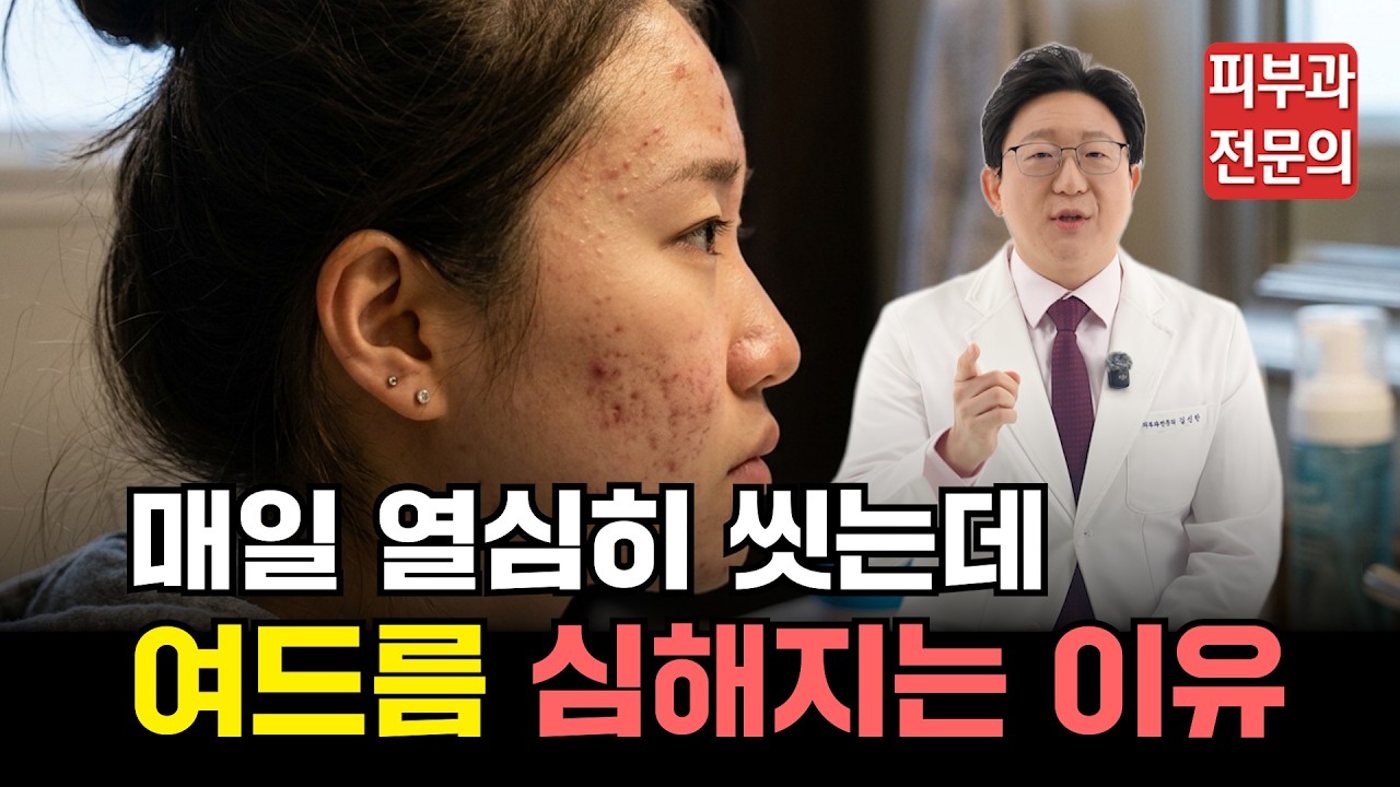 매일 깨끗이 씻는데 여드름이 폭발하는 진짜 이유