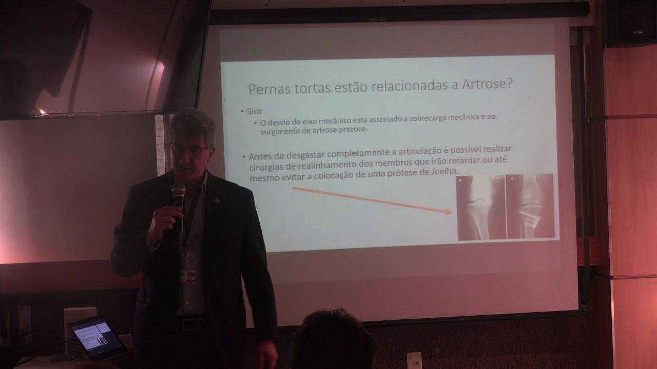 ARTROSE botafogo parana