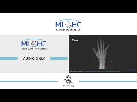 ID 74: Faster R-CNN Detection of Fractures in Pediatric Upper Extremity Radiographs