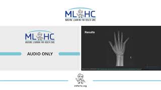 ID 74: Faster R-CNN Detection of Fractures in Pediatric Upper Extremity Radiographs