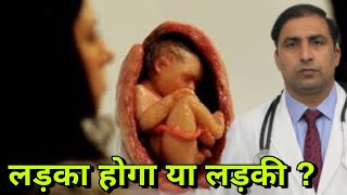 लडक हग य लडक जनए कस तय हत ह ? Will It Be A Boy Or Girl Dr Kumar Education Clinic