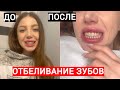 ОТБЕЛИВАЮ ЗУБЫ В САЛОНЕ КРАСОТЫ! Я РАЗОЧАРОВАНА. ДО И ПОСЛЕ + ЦЕНЫ