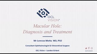 OCL Vision Webinar - Macular Hole: Diagnosis & Treatment