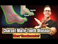 Charcot Marie Tooth Disease - Symptoms &amp; NEW Treatments! [2024]