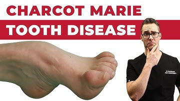Charcot Marie Tooth Disease - Symptoms & NEW Treatments! [2024]