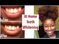 How i whitened my teeth at home  smile brilliant