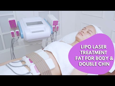 Lipo Laser | Lipo Laser Treatment | Lipo Laser Fat for Double Chin| Lipo Laser Fat | myChway 16101