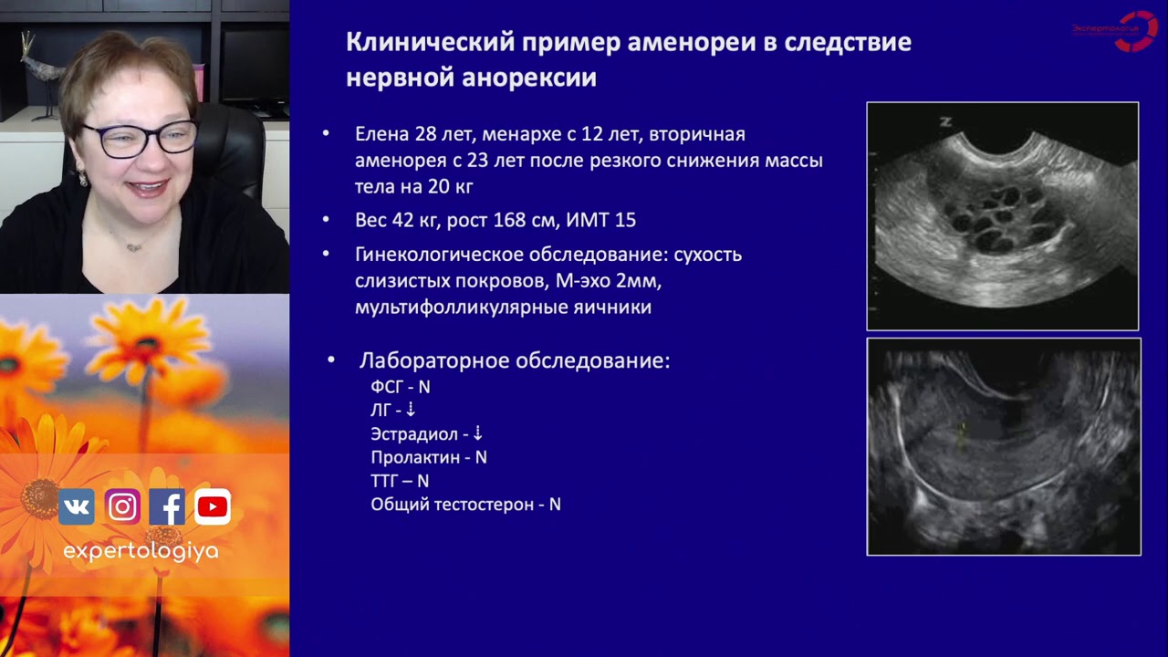 Экспертология | Аменорея и расстройства пищевого поведения