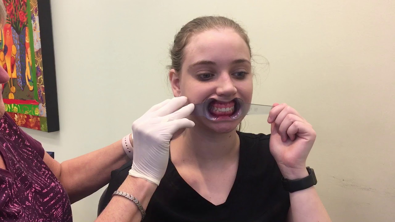 Taking full series orthodontic photos YouTube