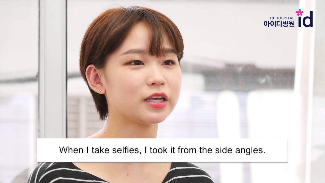 A girl with protruding ears underwent otoplasty (ear surgery) at ID Hospital, South Korea!!