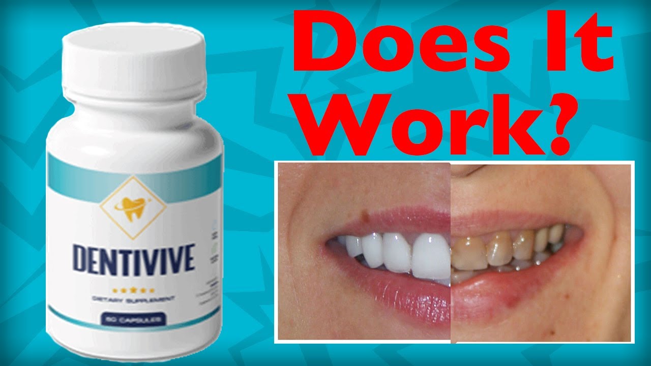Dentivive – Does It Work? Everything You Need To Know