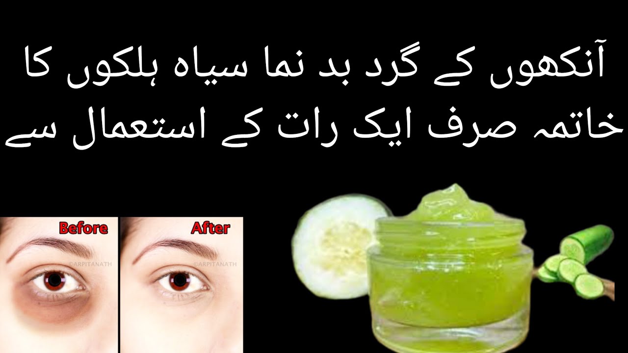 how to remove dark circle ,dark circle eye cream , dark circle home