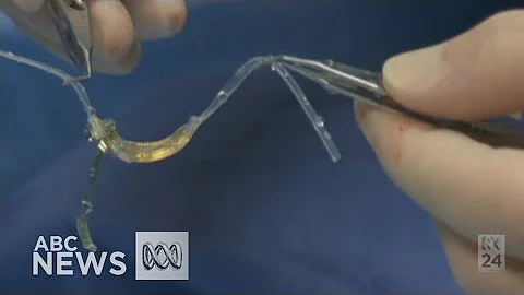 Bionic eye: Retinal implant a world first