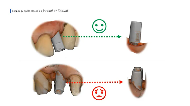 Scan Strategy_Scan Body (ENG)