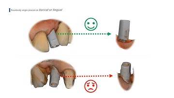 Scan Strategy_Scan Body (ENG)