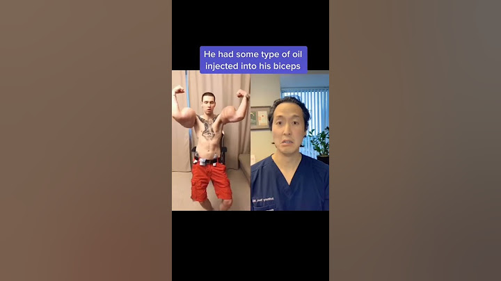 Doctor Reacts to Massive FAKE Biceps! #shorts #synthol