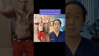 Doctor Reacts To Massive Fake Biceps 
