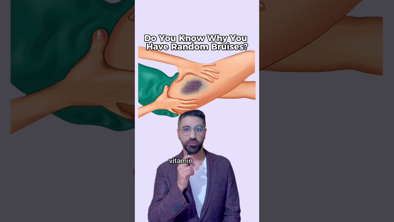 Do you know why you get random bruises?