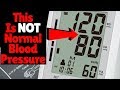 120 OVER 80 IS NOT NORMAL BLOOD PRESSURE RANGE | So What Is A Normal Blood Pressure Reading?