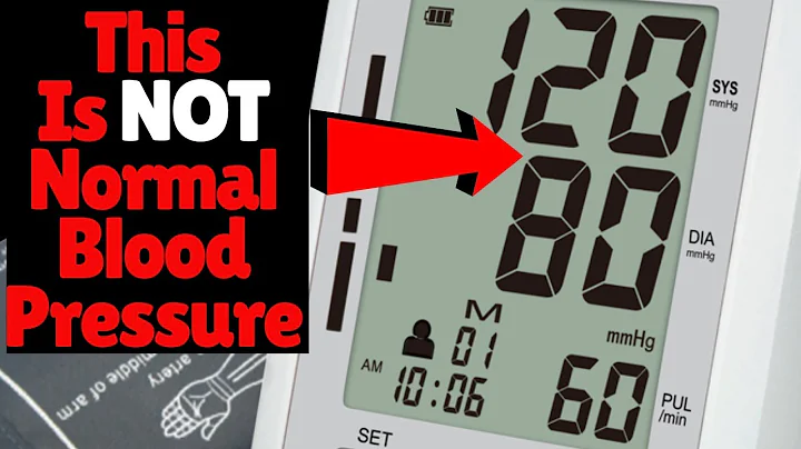 120 OVER 80 IS NOT NORMAL BLOOD PRESSURE RANGE | So What Is A Normal Blood Pressure Reading? - DayDayNews