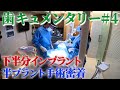 【新作歯キュメンタリー】糖尿病が襲いかかるインプラント手術に密着