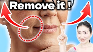 Night Power Routine to Remove Nasolabial Folds and Sagging & Wrinkles Around Mouth