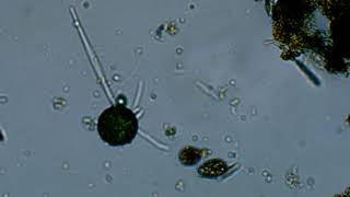 Shelled Amoeba Walking with Psuedopodia (in swamp water)