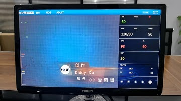 ECG DEMO on STM32MP1 based MYD-YA157C Dev Board with LCD & Mouse