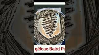 Gélose Baird Parker