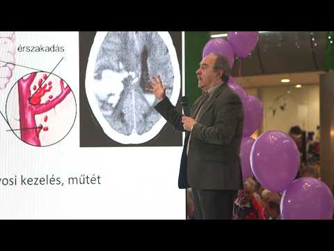 Dr. Horváth Sándor  A stroke típusai, a stroke tünetei | Stroke Napja 2018