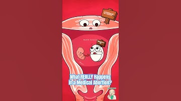 What REALLY Happens in a Medical Abortion? #pregnancy #animation
