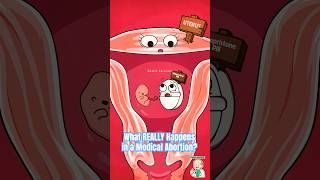 What Really Happens In A Medical Abortion?